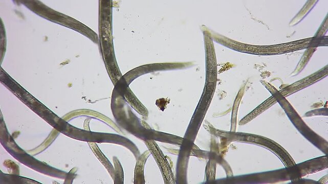 Large cluster of active nematode roundworms wriggling under 100x brightfield microscopy