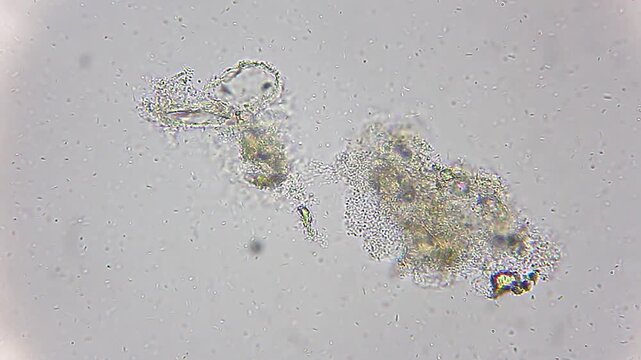 Massive bacterial colony swarming over decomposing organic detritus under 400x brightfield microscopy