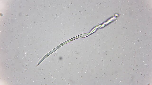 Massive colony of bacteria swimming around a synthetic fiber particle under 400x brightfield microscopy