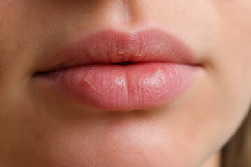 Obraz premium A close-up of a person's lips and mouth, showing natural skin texture.