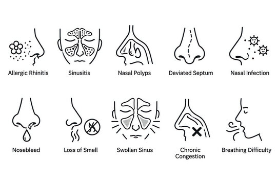 Common Nasal Disorders Sinusitis Rhinitis Polyps and Deviated Septum Icon Set