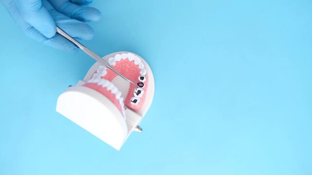 Dentist in blue medical gloves uses a dental instrument to point at a tooth model, highlighting dental health and treatment options on a vibrant blue background