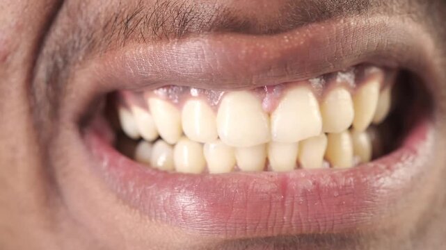 Close up of man with yellow stained teeth showing plaque buildup and gingivitis while grinding mouth in cinematic detail