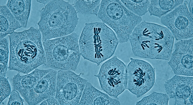 Human Cell Division and Mitosis with Visible Chromosomes Under Laboratory Microscope