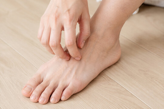 scratching itchy foot instep