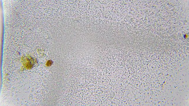 Colpoda ciliate protozoan swimming inside a massive swarm of dense bacteria under 400x brightfield microscopy