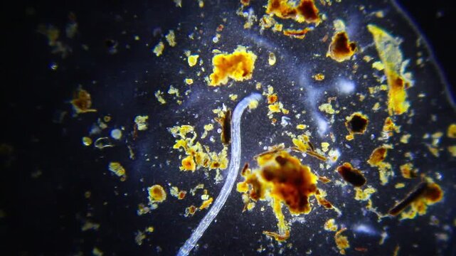 Large segmented annelid worm crawling through organic sediment under 40x darkfield microscopy