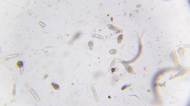 Rich biodiversity of freshwater pond ecosystem with nematodes rotifers and ciliates under 100x brightfield microscopy
