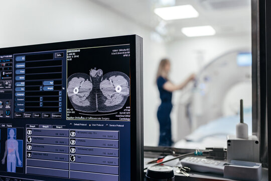 CT workstation displaying medical scan image while female radiology technologist works near computed tomography scanner in background.