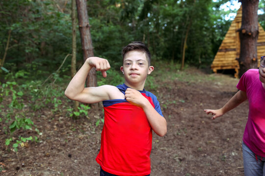Children with Down syndrome are vacationing at a camp.