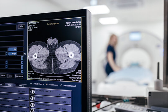 Close view of medical monitor displaying CT scan image with computed tomography scanner and healthcare worker blurred in background.