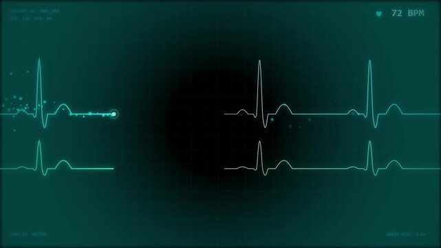 Digital medical monitor showing a normal sinus rhythm electrocardiogram heartbeat trace on a dark green screen