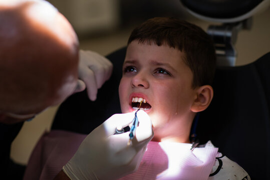 The image shows a dentist using a hand instrument to work on a young boy's front teeth, which is consistent with dental bonding or a composite restoration. This procedure is commonly used to repair ch