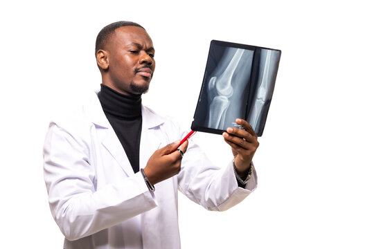 Doctor in white coat examining x-ray with concentration and focus in a medical office environment, highlighting diagnostic expertise and precision in radiography