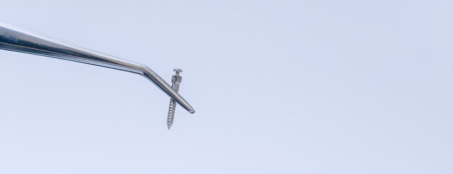 Orthodontic mini implant screw held with dental tweezers for temporary anchorage device placement and modern orthodontic treatment