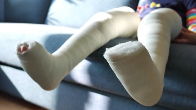 A little girl lies on a blue sofa with both legs in a cast, showing the white plaster and exposed toes, slow motion video clip