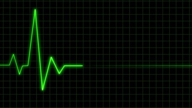 Digital EKG heart rate monitor animation looping on black background in 4K.