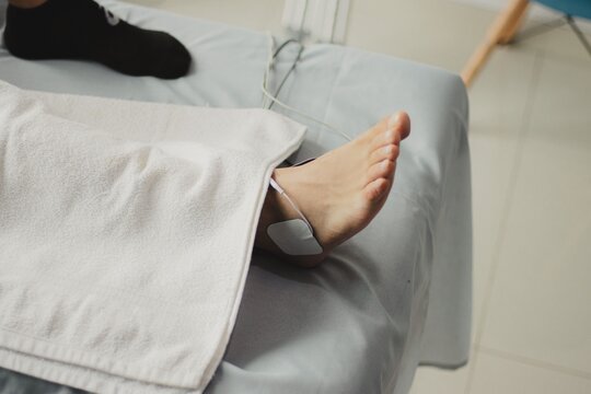Electrical muscle stimulation electrode pad placed on patient foot for physical therapy treatment