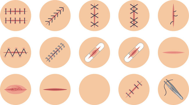 Surgical Medical Suture Vector Set with Wound Stitches Scars Plasters and Tweezers for Healthcare Education Graphic Designs