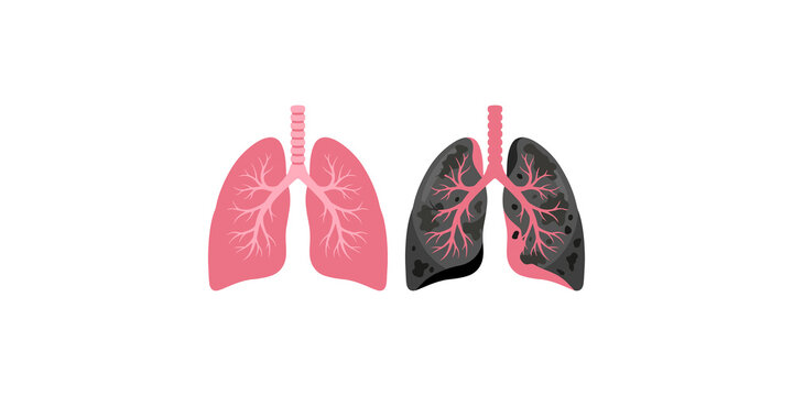 Healthy and smoker lungs comparison vector graphic showing pink clean organ next to diseased damaged lung.