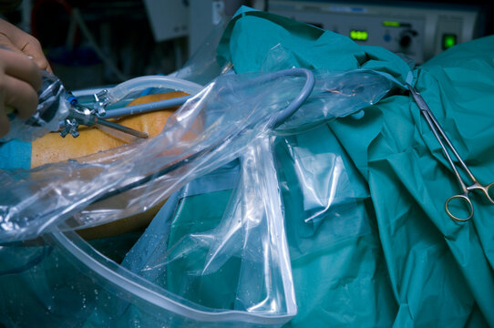 Knee surgery
