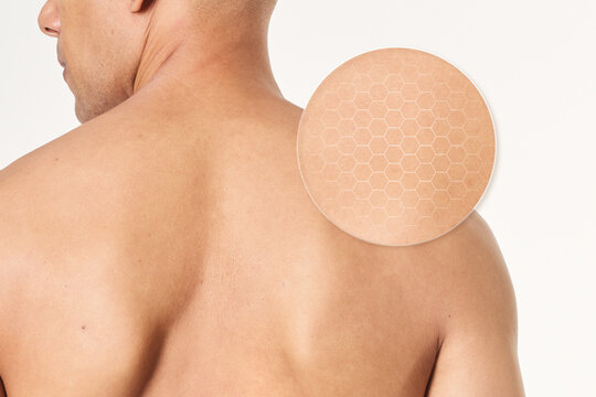Patch applied on bare back