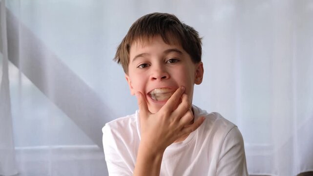 Young caucasian boy takes the aligner out of his mouth. A young boy uses the orthodontic mouthguard. Dental care, oral hygiene, teeth alignment. HQ 4k footage.