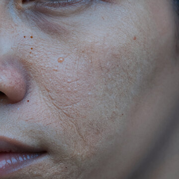 Blueprint Texture Organ. Close-Up Image Of Detailed Human Skin Texture