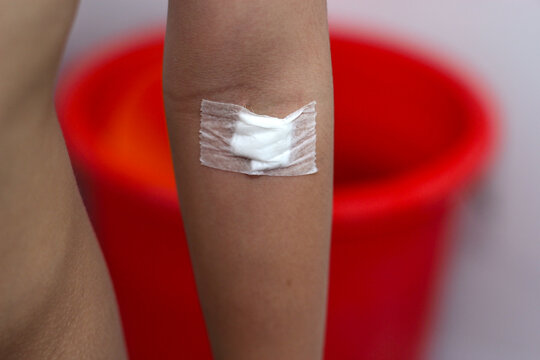 close-up of a person's inner elbow arm covered with a medical cotton gauze pad and adhesive tape after a blood test or injection