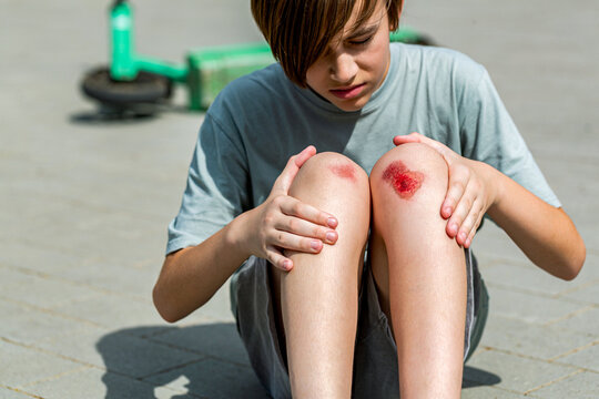 Child injured his knee when he fell off the scooter. Blood and scratched skin. Concept of summer holidays. Boy fell off a scooter and broke his knee. Boy worried about leg injury