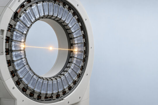 Gamma Ray Detection in Scintillator Scanner Ring