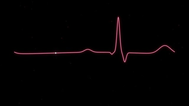 ECG Heartbeat Waveform displayed in sequence against a dark background with subtle cinematic motion