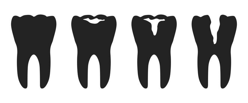 Dental diseases. Healthy tooth and teeth with caries. Hand-drawn vector icon set