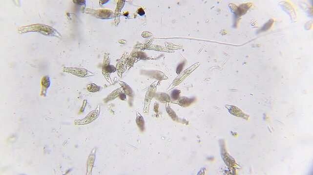 Massive colony of active rotifers swarming with ciliates under 100x brightfield microscopy