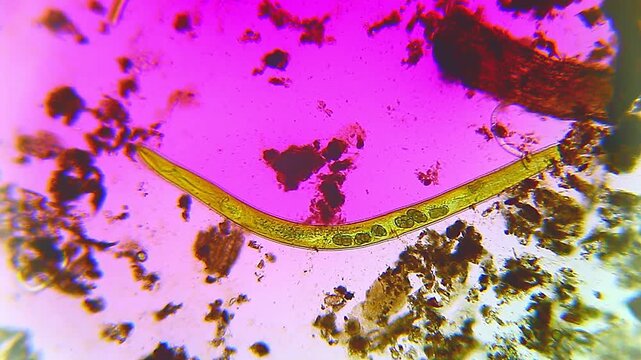 Nematode roundworms crawling through organic soil detritus particles under 40x brightfield microscopy