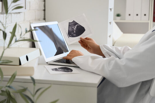 Female gynecologist working with laptop and sonogram image at desk in medical office