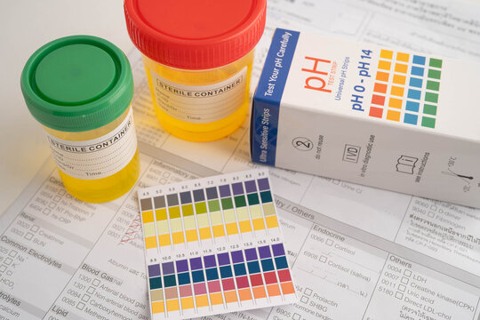 Urinalysis, urine cup with reagent strip pH paper test and comparison chart in laboratory.