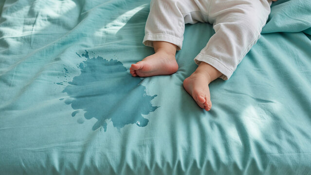 Baby feet on wet bedsheet, bedwetting problem and infant hygiene concern
