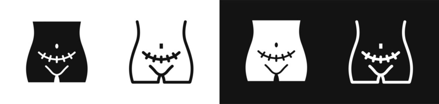 C-section scar icon set
