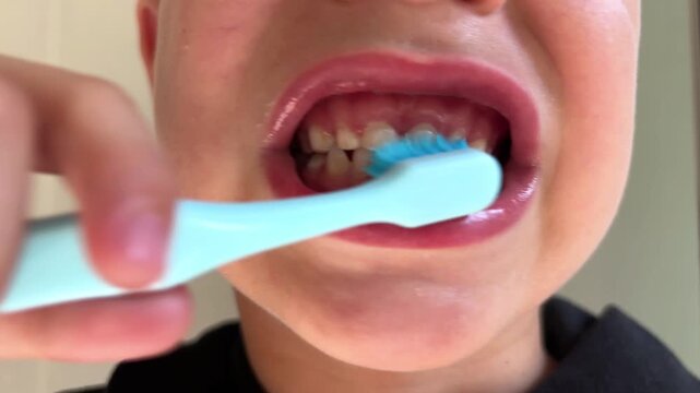 Child with primary teeth brushes front teeth from side to side, showing visible enamel changes. Dental hygiene, incorrect brushing, pediatric dentistry.