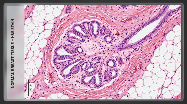 Microscopic view of normal breast tissue with H&E stain showing lobules