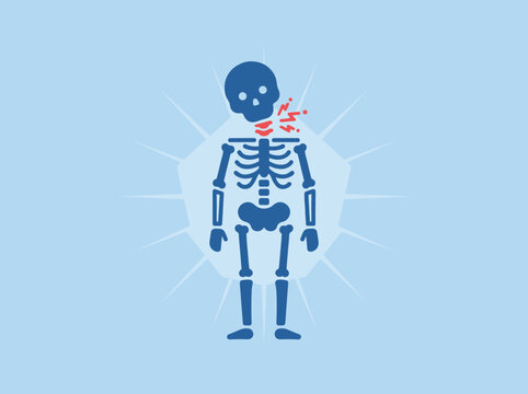 Human Skeleton with Highlighted Red Neck Pain Cervical Spine Injury Front View Medical Flat Design Vector