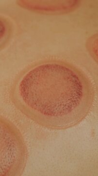 vertical closeup shows cupping suction bruise with dotted skin texture inside rounded cups, diffuse warm light