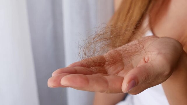 Close-up of woman showing clump of fallen hair in palm after excessive hair loss and shedding