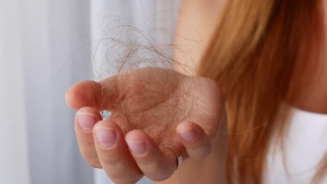 Close-up of woman holding clump of fallen hair in hand showing excessive hair loss and shedding problem