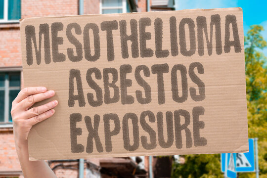 "Mesothelioma asbestos exposure" Rare cancer from toxic fiber inhalation. MESOTHELIOMA. ASBESTOS. TOXIN. OCCUPATIONAL. EXPOSURE.