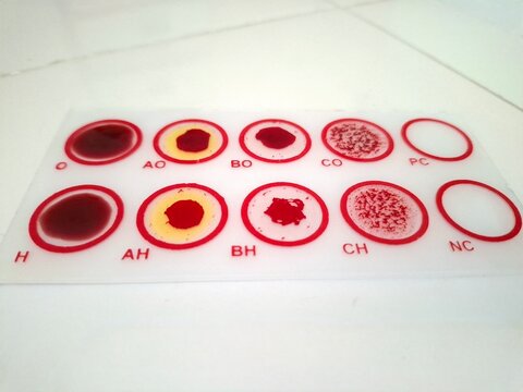Top view of a blood typing test kit slide showing agglutination reactions in circular wells for ABO and Rh blood group identification in laboratory.