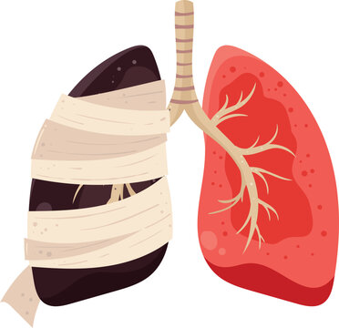 Healthy and Diseased Lung with Smoking Damage Concept