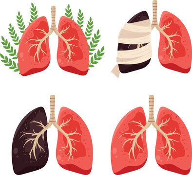 Healthy and Damaged Lungs Comparison Medical Illustration Set