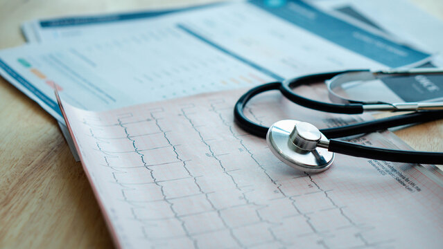 Stethoscope rests on an electrocardiogram during cardiac analysis. Close-up scene shows ECG traces, heartbeat waveform, heart rhythm monitoring, cardiology diagnosis, screening, and hospital care.